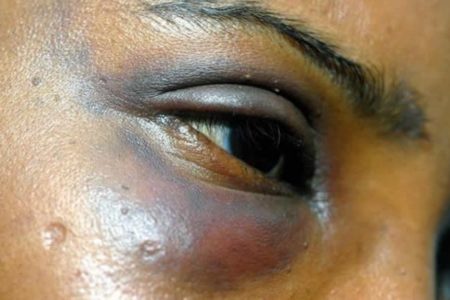 Observatório das mulheres marcha contra práticas criminais a mulher incluindo abuso sexual
